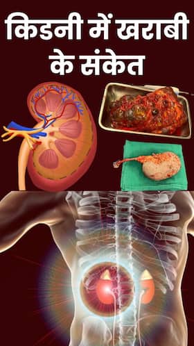 किडनी में खराबी होने पर दिखते हैं ये 8 संकेत