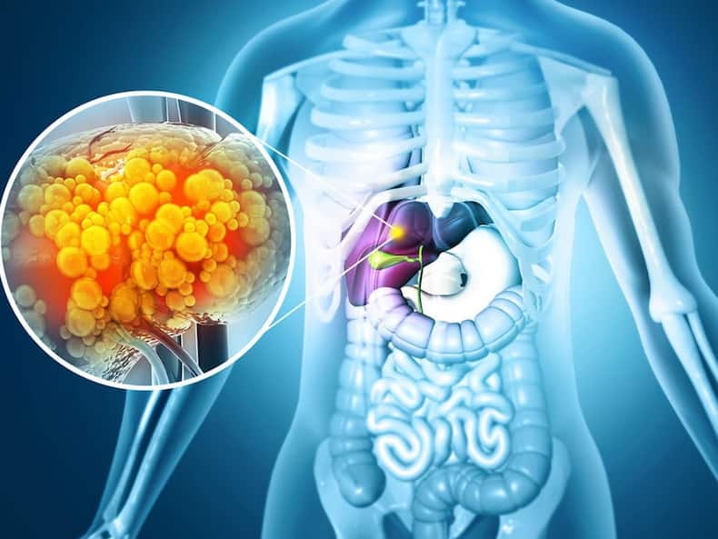 Liver Health And Diabetes: Understanding The Connection