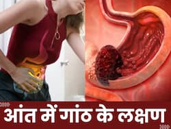 दिन में किसी भी समय दिखने वाले इन 5 संकेतों से समझ जाएं आंतों में पड़ गई है गांठ, तुरंत कराएं अपना इलाज