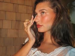 What Is Perioral Dermatitis That Model Hailey Bieber Is Diagnosed With?