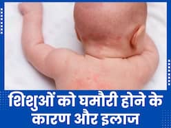 गर्मियों में शिशुओं को क्यों जाती है घमौरी? एक्सपर्ट से जानें इसे ठीक करने के तरीके