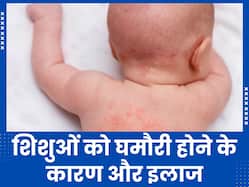 गर्मियों में शिशुओं को क्यों जाती है घमौरी? एक्सपर्ट से जानें इसे ठीक करने के तरीके