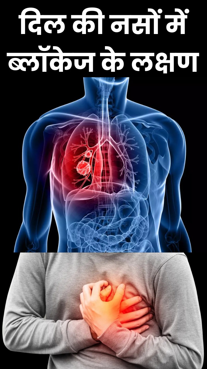 दिल की नसें ब्लॉक होने पर दिखते हैं ये 8 लक्षण
