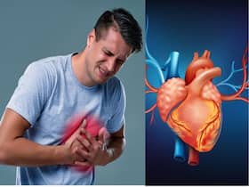 Keep Your Heart Healthy: Increase Your Intake Of Good Over Bad Fats