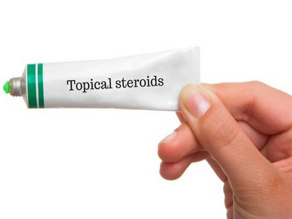 The Hidden Dangers Of Topical Steroid Abuse Unveiling The Truth Behind Skin Health