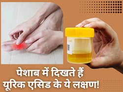 यूरिक एसिड हाई होने पर पेशाब में दिखते हैं ये 5 लक्षण, साधारण समझकर न करें इग्नोर