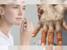 High Cholesterol Symptoms In Women 40s: Top 7 Unusual Signs of High LDL Levels On Hands And Fingers