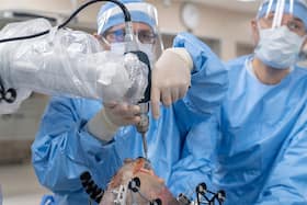 Robotic Knee Replacement Surgery: When To Consider, Benefits And Recovery Time Robotic Knee Replacement Surgery: When To Consider, Benefits And Recovery Time