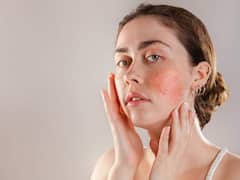Skincare Routine To Manage Redness On Face
