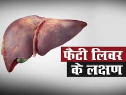 फैटी लिवर होने का संकेत है शरीर के इन 4 हिस्सों में सूजन, जानिए Fatty Liver होने के शुरुआती लक्षण