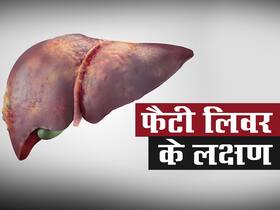 फैटी लिवर होने का संकेत है शरीर के इन 4 हिस्सों में सूजन, जानिए Fatty Liver होने के शुरुआती लक्षण फैटी लिवर होने का संकेत है शरीर के इन 4 हिस्सों में सूजन, जानिए Fatty Liver होने के शुरुआती लक्षण