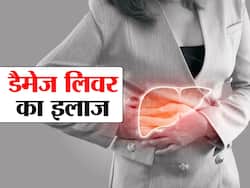 फैटी लिवर में मेडिसिन से ज्यादा कारगर हैं ये 4 चीजें, अधिकांश लोग करते हैं इन्हे नजरअंदाज