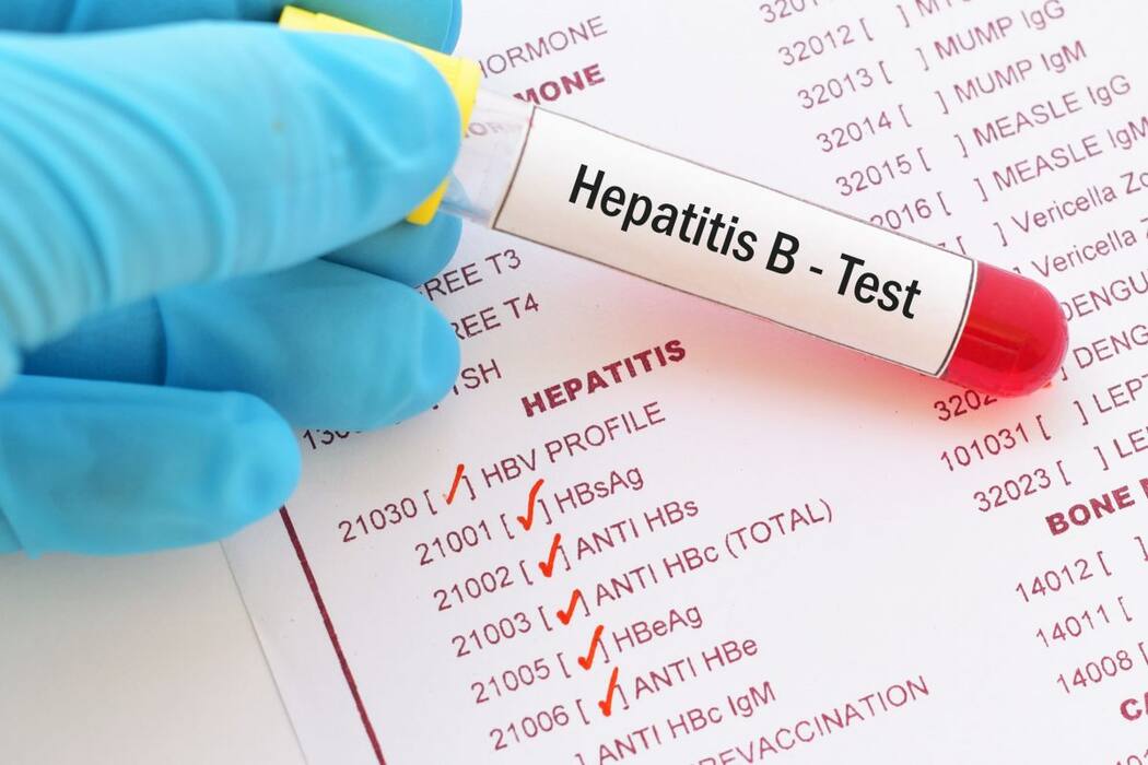 Let Us Understand The Role Of Hepatitis A And B In Liver Disease
