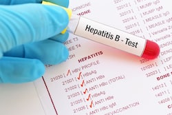 World Liver Day: Prioritizing Viral Hepatitis Screening With Comprehensive Testing