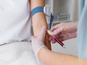 Important Blood Tests For Overall Health: How Often Should You Get These 6 Tests Done?