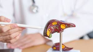Dispelling The Myth: Exploring 5 Causes Of Liver Disease Beyond Alcoholism - Vimarsana News