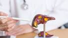 Dispelling The Myth: Exploring 5 Causes Of Liver Disease Beyond Alcoholism