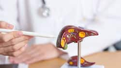 Dispelling The Myth: Exploring 5 Causes Of Liver Disease Beyond Alcoholism