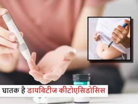 क्या है डायबिटिक कीटोएसिडोसिस? डॉक्टर ने बताए इस जानलेवा बीमारी के लक्षण और इलाज का तरीका क्या है डायबिटिक कीटोएसिडोसिस? डॉक्टर ने बताए इस जानलेवा बीमारी के लक्षण और इलाज का तरीका