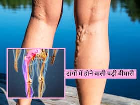 Numbness in legs: सुबह के समय पैर सुन्न रहना हो सकता है कई गंभीर बीमारियों का लक्षण, इग्नोर न करें ये संकेत Numbness in legs: सुबह के समय पैर सुन्न रहना हो सकता है कई गंभीर बीमारियों का लक्षण, इग्नोर न करें ये संकेत
