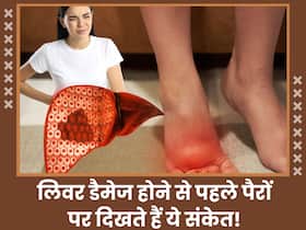 लिवर फेल होने से पहले पैरों के आसपास दिखने लगते हैं ये 5 बदलाव, तलवों में भी होने लगती है खुजली लिवर फेल होने से पहले पैरों के आसपास दिखने लगते हैं ये 5 बदलाव, तलवों में भी होने लगती है खुजली