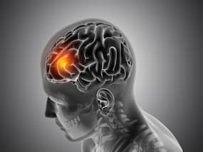 Early Warning Signs Of Mini Stroke: What Are The 5 Main Symptoms That You Must Take Note Of?