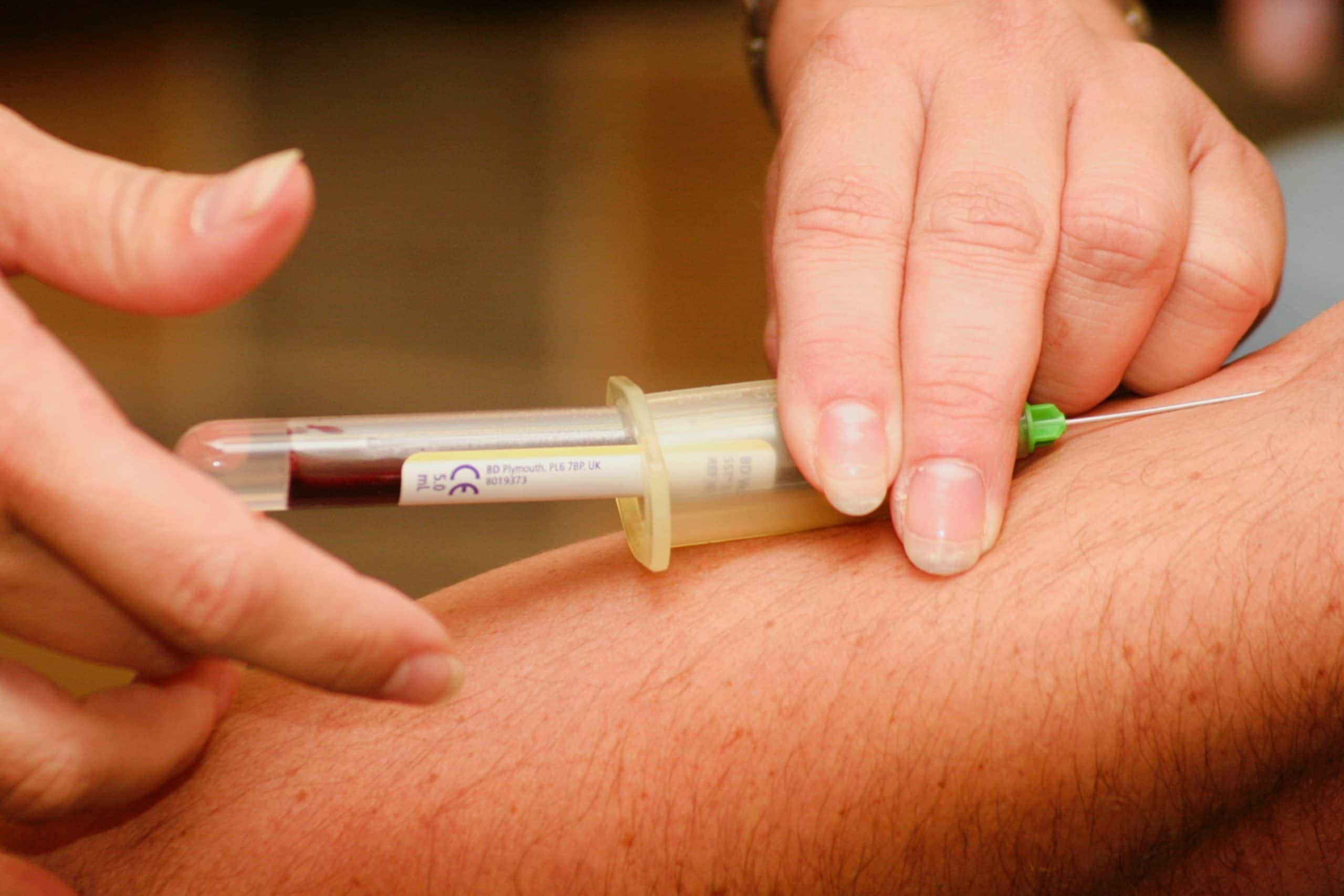 Types Of Haemophilia: 5 Available Diagnostic Tests For This Rare Genetic Disorder - Vimarsana News