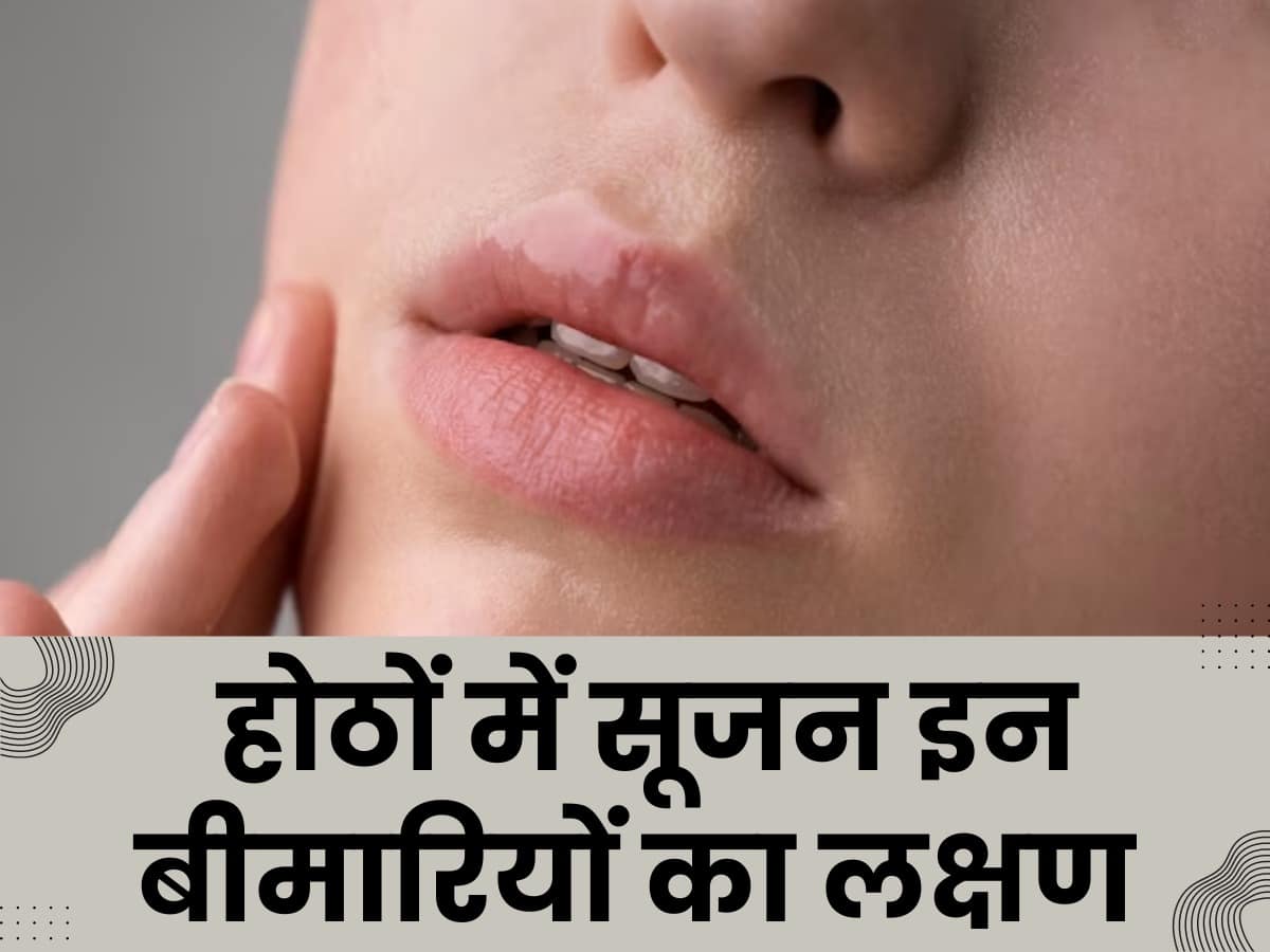 लिप्स की सूजन हो सकती है इन गम्भीर बीमारियों का संकेत, बिना देर किए