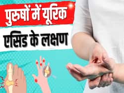 Uric Acid Symptoms in Men: पुरुषों में रात को दिखने वाले यूरिक एसिड के ये हैं लक्षण