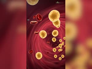 10 Natural Ways To Reduce High Cholesterol Levels Without Medication