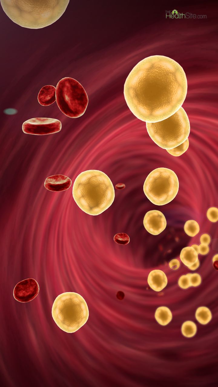 10 Natural Ways To Reduce High Cholesterol Levels Without Medication