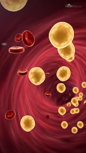 10 Natural Ways To Reduce High Cholesterol Levels Without Medication