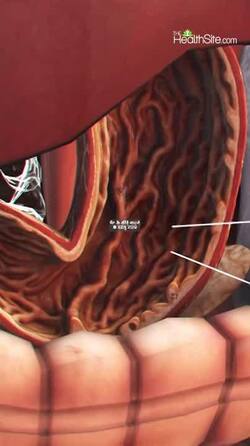 Home remedies to kill stomach worms