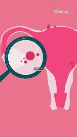 Endometriosis Warning Signs