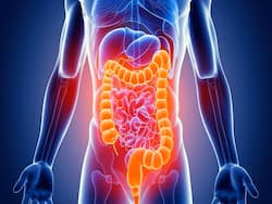 Inflammatory Bowel Disease In Women: All You Need To Know About This Health Issue