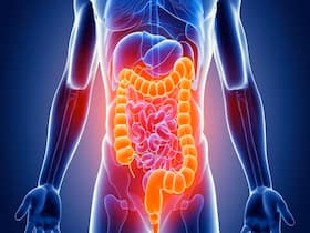 Inflammatory Bowel Disease In Women: All You Need To Know About This Health Issue