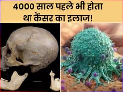 आज से ही नहीं 4000 साल पहले से ही हो रहा है कैंसर का इलाज, रिसर्च में खोपड़ी पर मिले ट्यूमर को ठीक करने के  निशान!