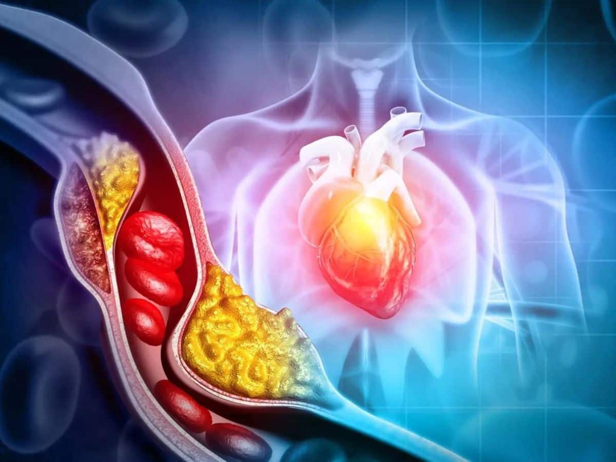 10 Healthy Morning Routines You Must Follow To Regulate High Cholesterol Levels