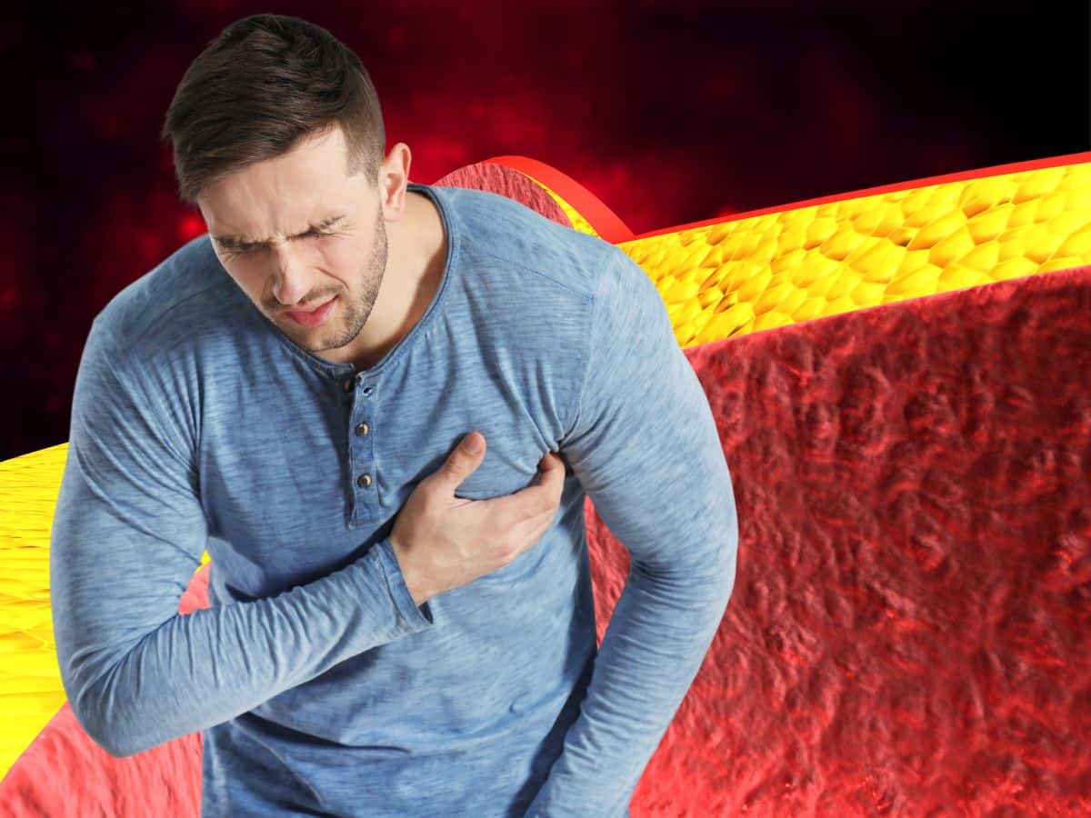 Heart Blockage: Top 7 Dangerous Foods That Can Clog Heart Arteries And Cause Stroke