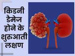 सबसे पहले हाथों-पैरों में दिखते हैं गुर्दे की बीमारियों के लक्षण, जानिए किडनी डैमेज होने के 4 शुरुआती संकेत