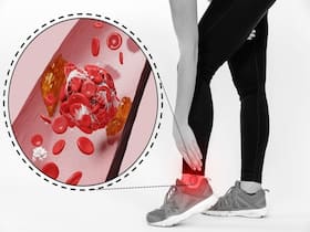 11 Important Facts About Deep Vein Thrombosis That Pregnant Women Must Know 11 Important Facts About Deep Vein Thrombosis That Pregnant Women Must Know