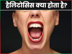 क्या है हैलिटोसिस की बीमारी? डॉक्टर से जानें इसके कारण और उपचार