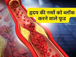 तुरंत हार्ट अटैक का कारण बन सकते हैं आपके ये 3 फेवरेट फूड, सोच समझकर खाएं इन्हें