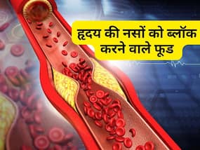 तुरंत हार्ट अटैक का कारण बन सकते हैं आपके ये 3 फेवरेट फूड, सोच समझकर खाएं इन्हें