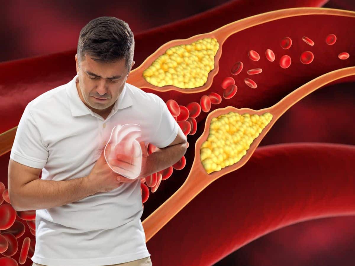 Heart Health: Top 10 Superfoods To Unblock Clogged Arteries And Prevent Summer Stroke Naturally