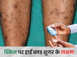शुगर बढ़ने पर स्किन पर दिन-रात कभी भी नजर आ सकते हैं ये संकेत, दिखते ही पहुंचे डॉक्टर के पास