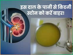 बिना सर्जरी के किडनी में पथरी को बाहर निकाल फेंकेगा इस दाल का पानी, रोजाना ऐसे करें सेवन
