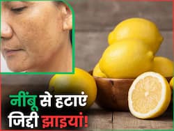 चेहरे की जिद्दी झाइयों को हटाने के लिए नींबू में मिलाकर लगाएं ये 3 चीजें, कुछ ही दिनों में निखर जाएगी त्वचा