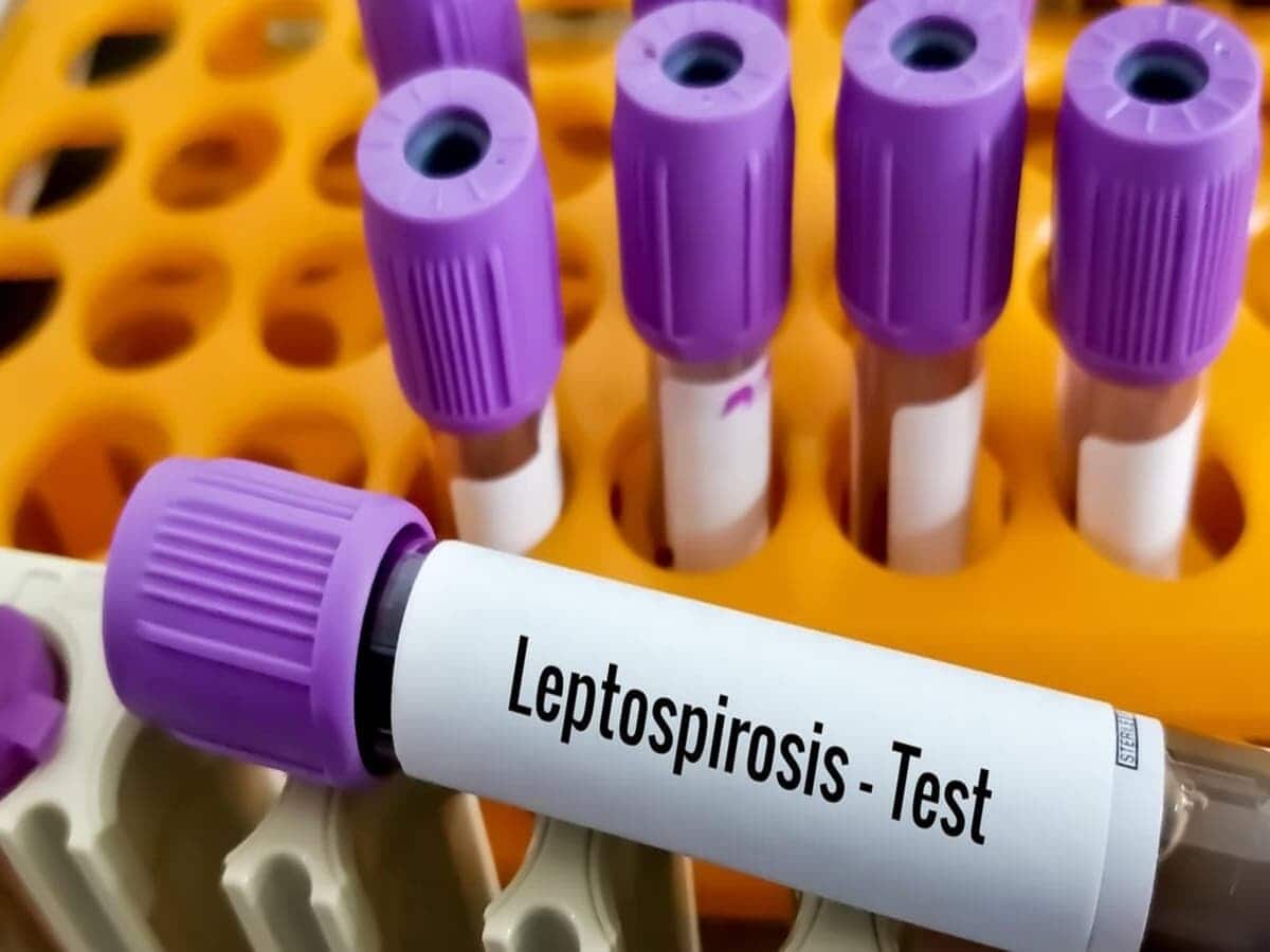 Leptospirosis