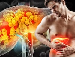 मामूली से दिखने वाले इन 5 संकेतों से समझ जाएं पूरी तरह से खराब हो चुका है लिवर, कहीं आप तो नहीं कर रहे इग्नोर